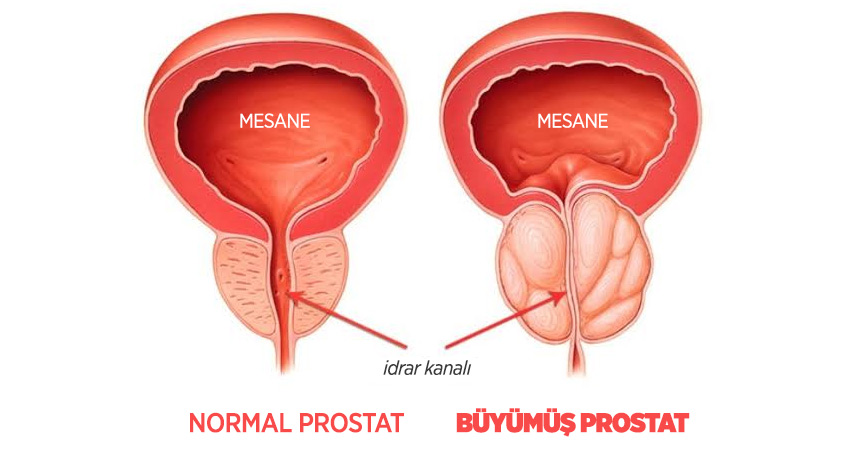 ayakta_idrar_yapmak_3