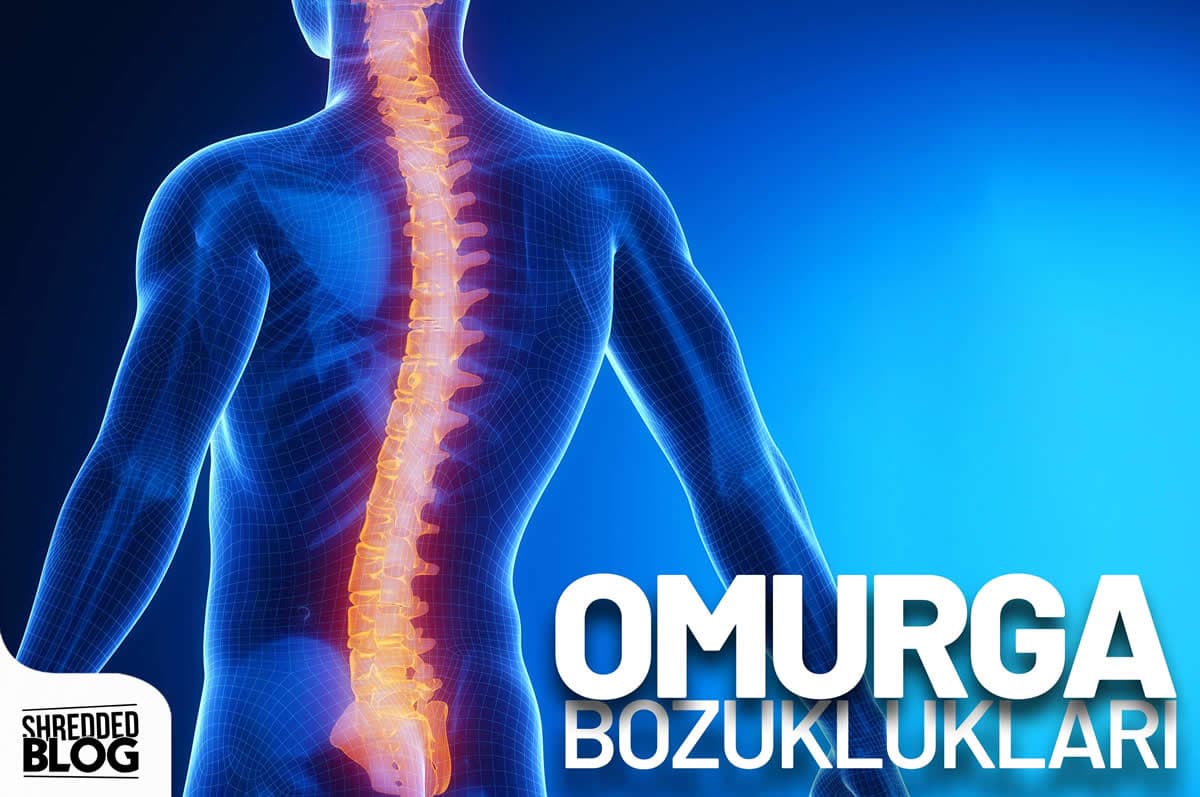 Omurga Bozuklukları ana görsel